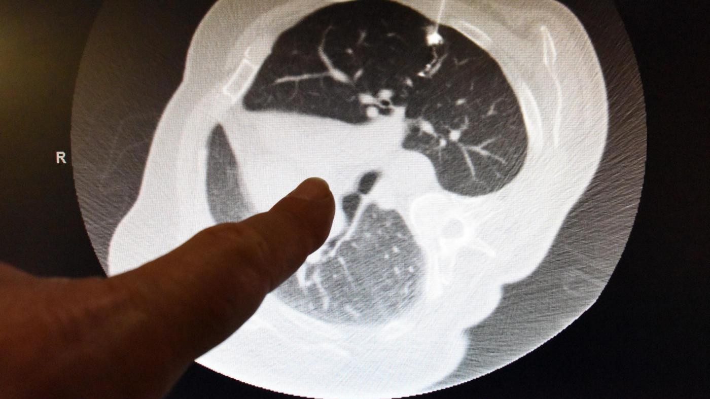 Un test per fotografare il cancro: la nuova frontiera della lotta alla malattia