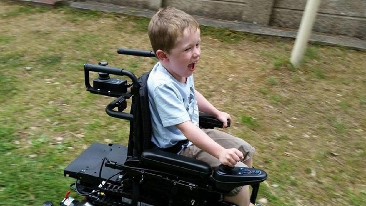 Distrofia di Duchenne, un gene artificiale apre la strada a nuove terapie