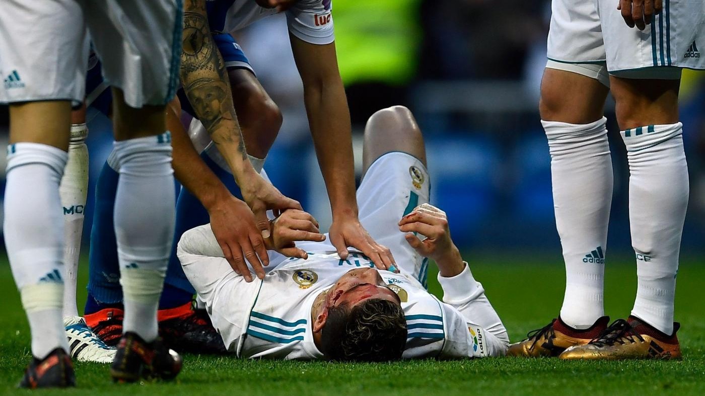 Si specchia dopo essersi ferito: critiche su Ronaldo. Ma Zidane lo difende