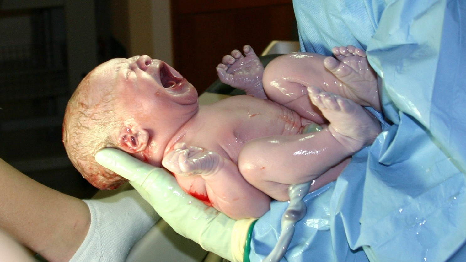 Violenza ostetrica, 21% mamme subisce traumi durante parto