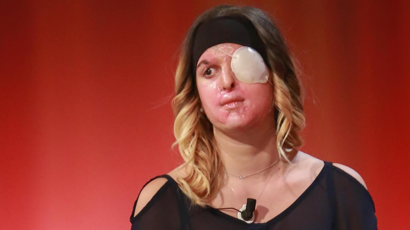 Rimini, condannato a 10 anni l’ex di Gessica Notaro, sfregiata con l’acido