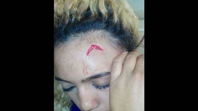 Caso in Zimbabwe: la first lady aggredisce una modella 20enne