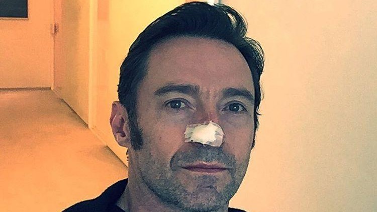 Hugh Jackman operato per tumore della pelle: Usate creme solari