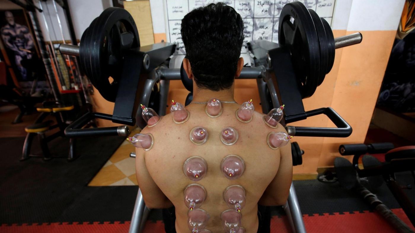 FOTO Cerchi rossi sui corpi degli atleti? E’ l’effetto del ‘cupping’