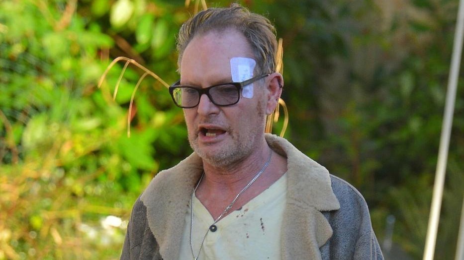 Nuovo ricovero in clinica per Paul Gascoigne