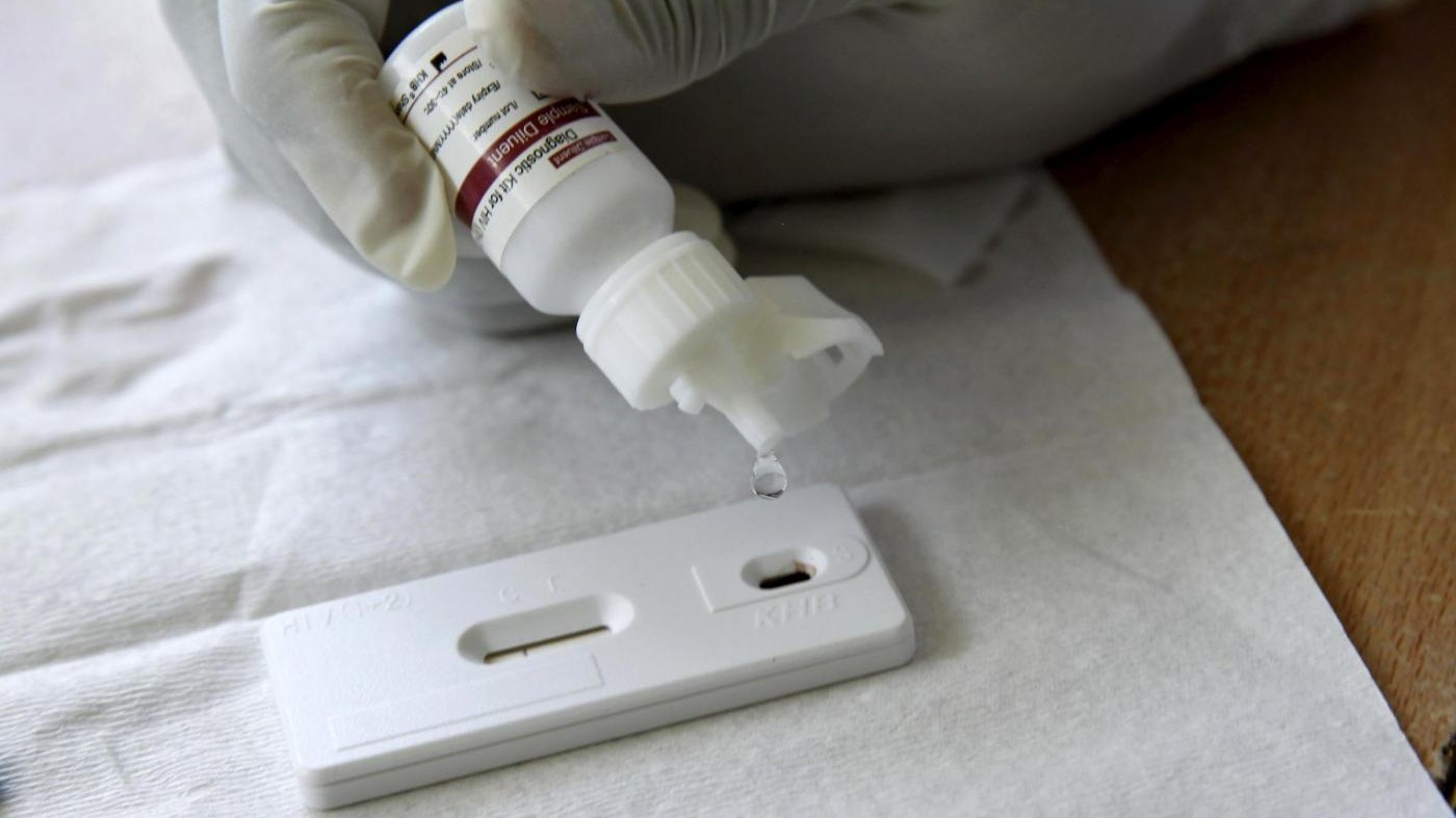 Sieropositivo che infettava donne accusato di epidemia dolosa