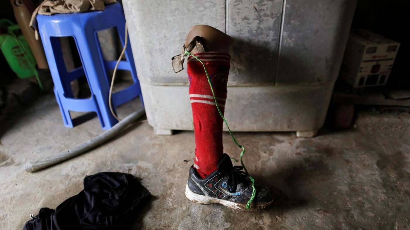 FOTO – Myanmar, le mutilazioni dei veterani dopo la guerra civile