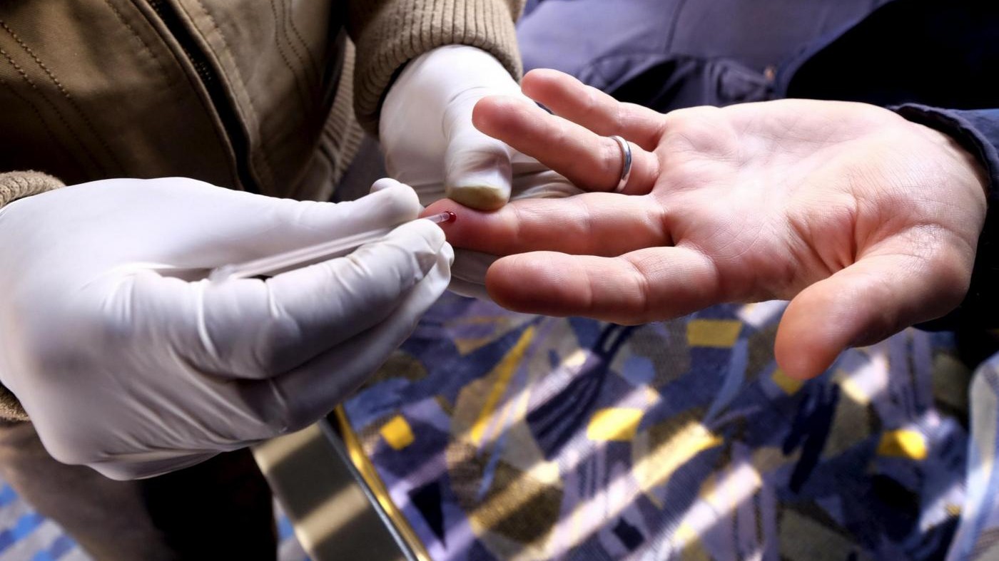 Hiv e sport: l’attività fisica migliora la salute dei malati