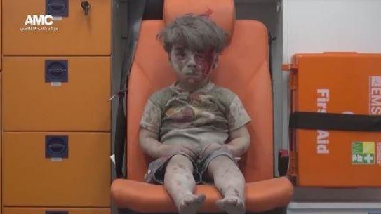 Il piccolo Omran ad Aleppo: l’orrore della guerra in una foto