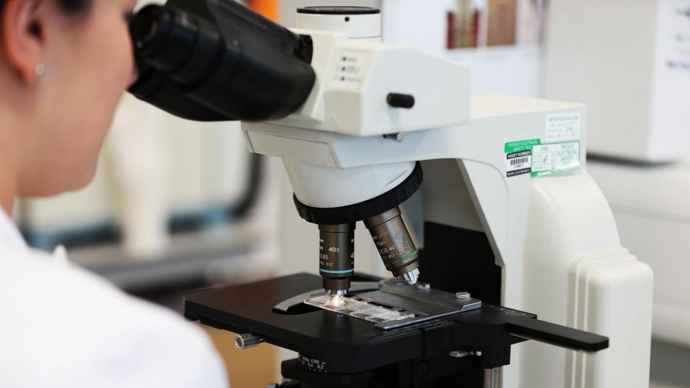 Individuata firma molecolare per forme gravi di tumore ovarico