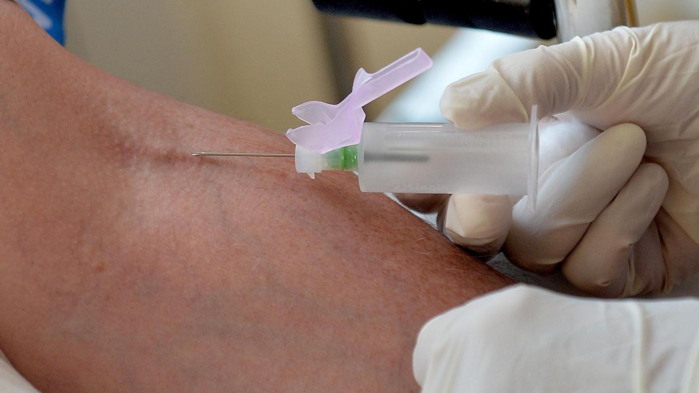 Tumore retto, con diagnosi precoce guarigione al 90%