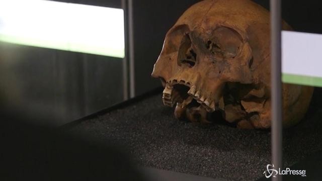 Il teschio di un gladiatore romano in mostra a Londra