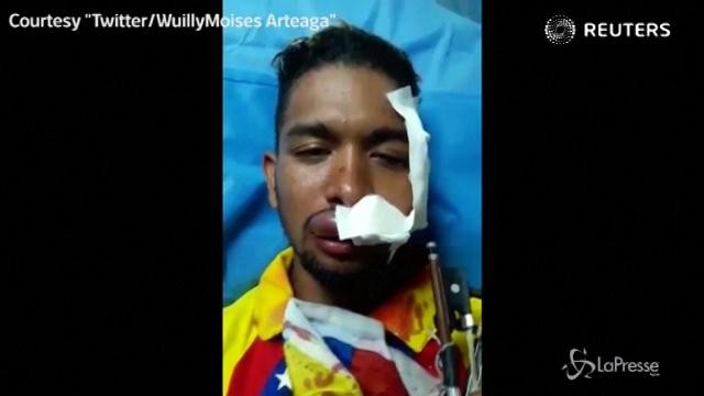 Venezuela: ferito il violinsita simbolo dell’opposizione