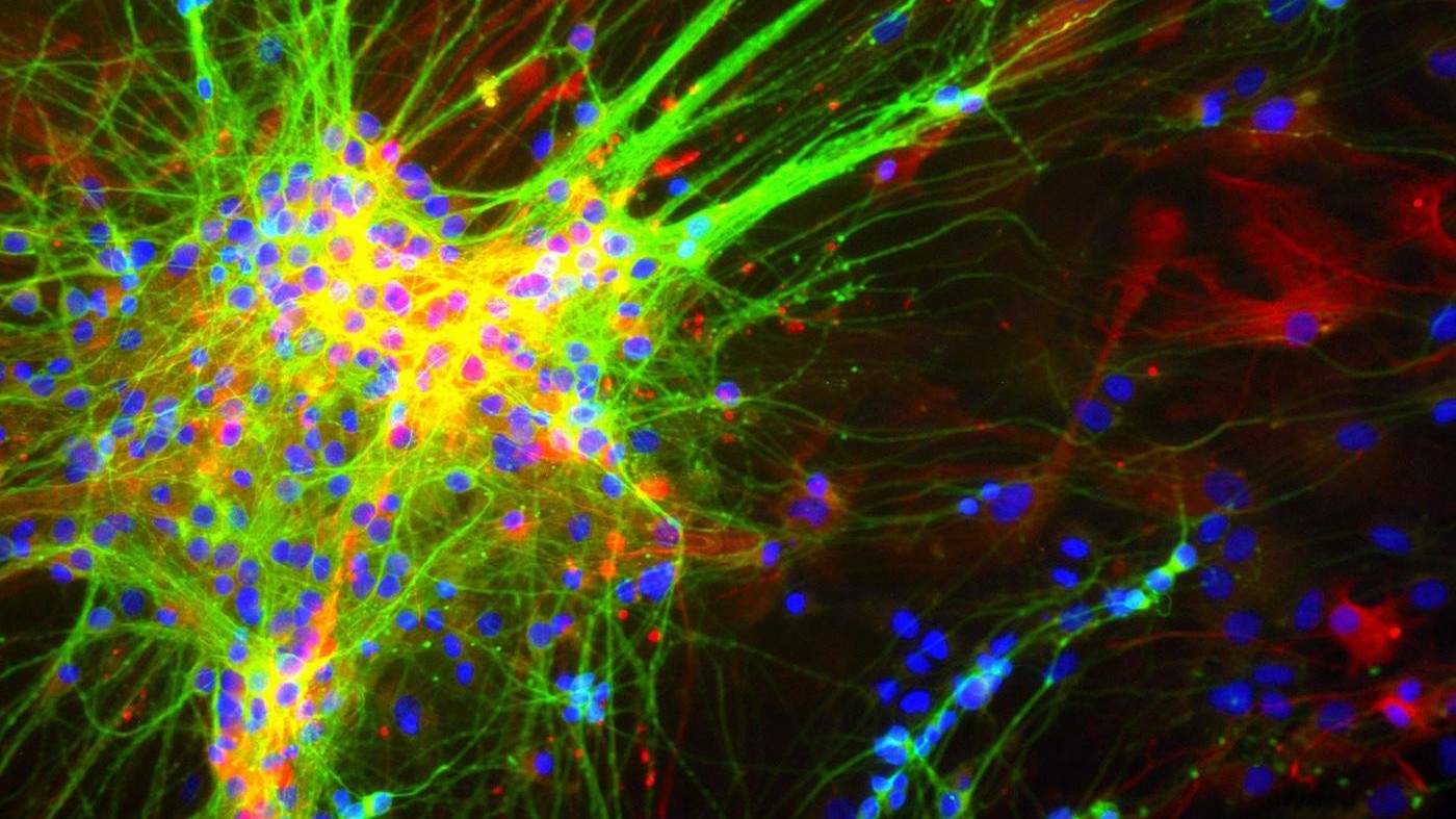 Scienza, il cervello non ha sesso, ognuno è un mosaico