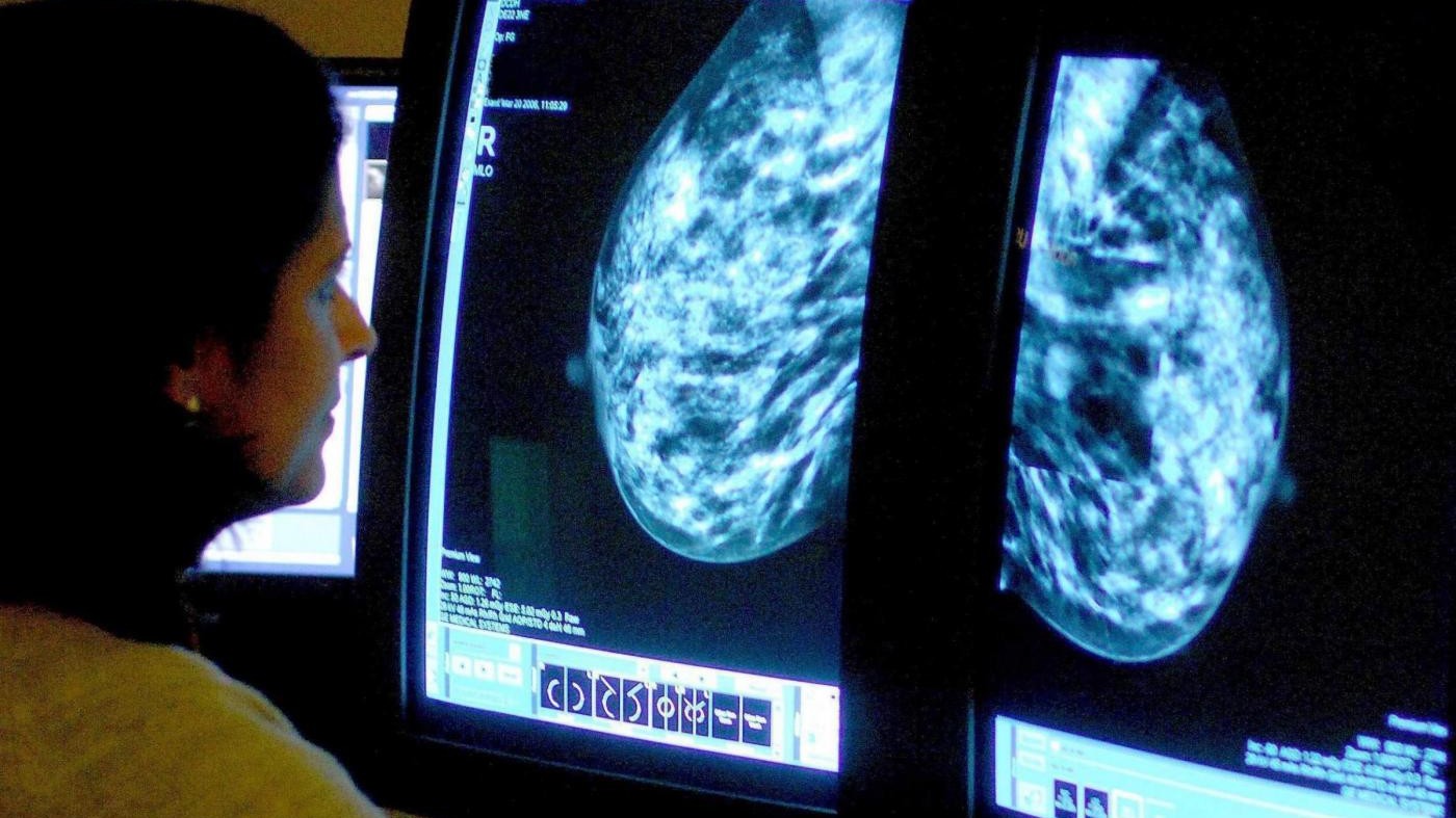 Salute, tumori: in 20 anni +10% sopravvivenza per donne italiane