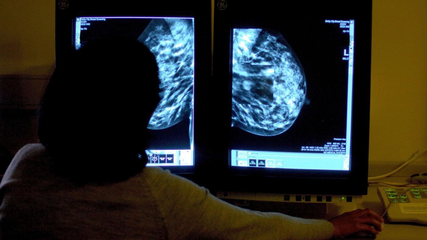 Salute, quasi il 70% degli italiani sconfigge il cancro