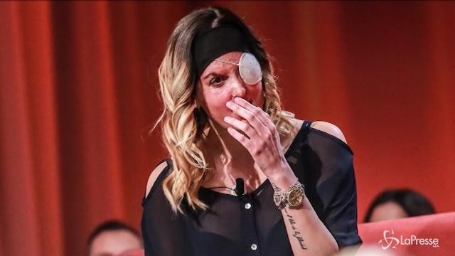 VIDEO Sfregiata con l’acido mostra il volto al Maurizio Costanzo Show