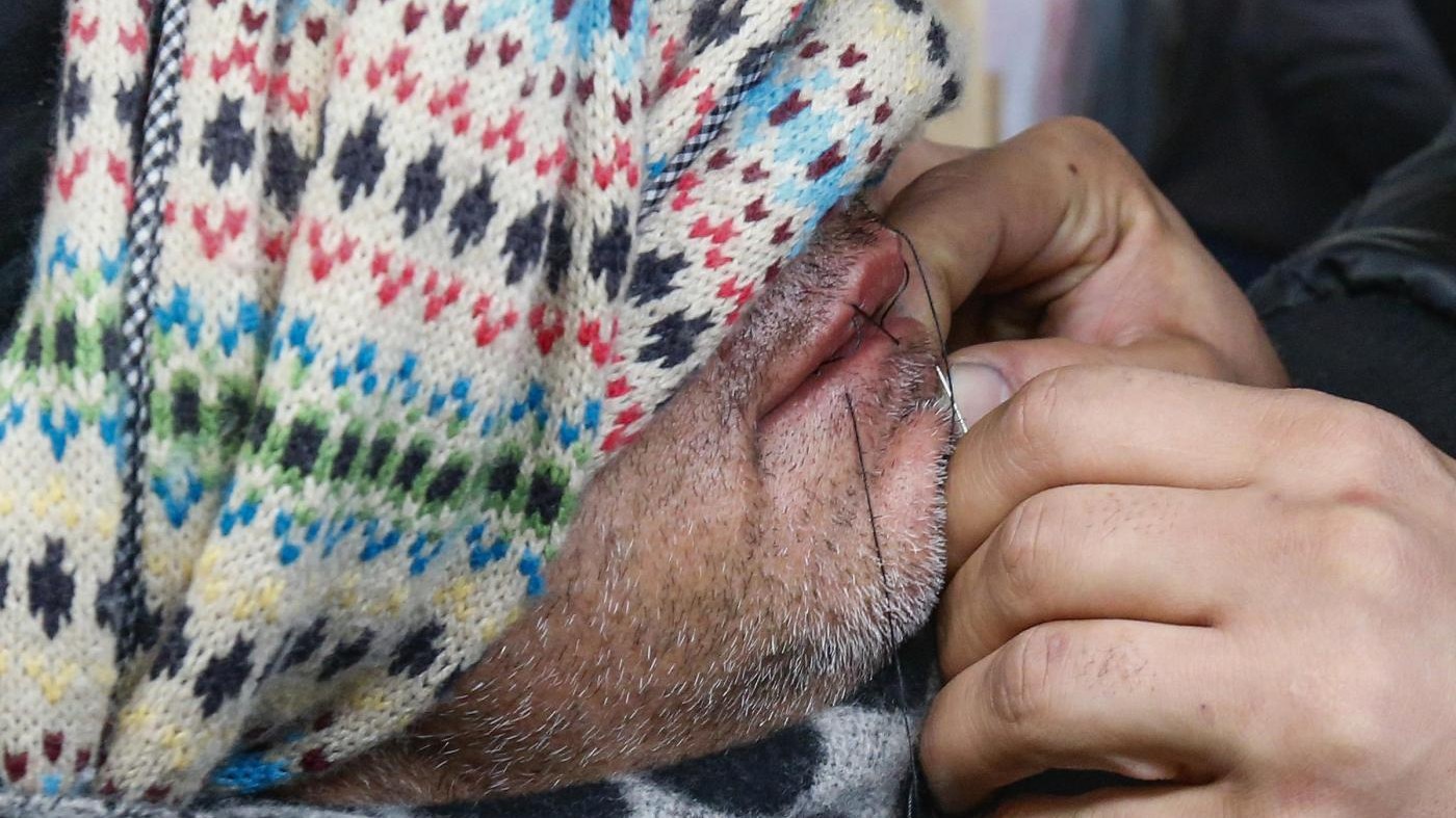 Migranti, gruppo profughi iraniani si cuce bocca per protesta