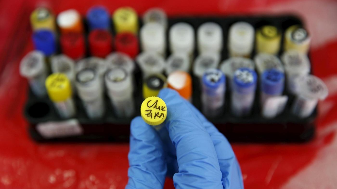 Zika, Usa confermano primo contagio con rapporto sessuale