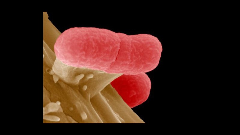 Batterio killer, si indaga su semi importati da Egitto