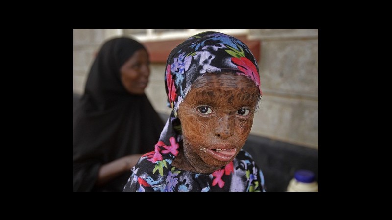 Tragedia senza fine nel corno d’Africa