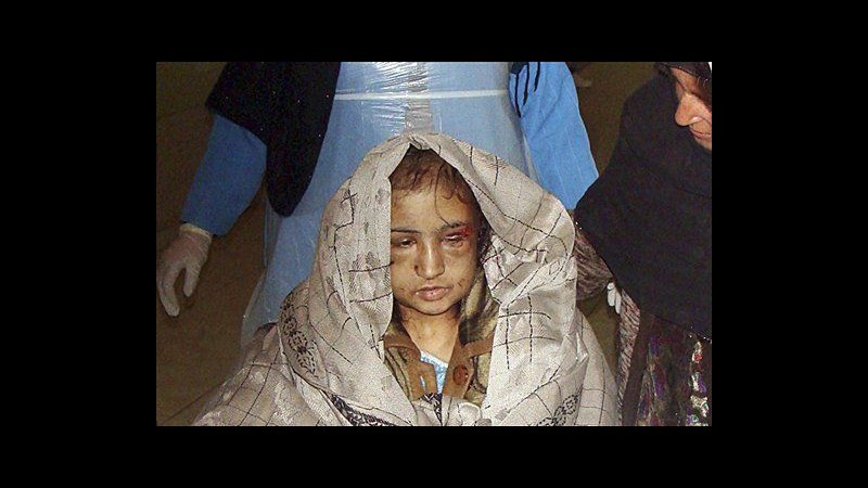 Afghanistan, 15enne torturata da parenti andrà in India per cure
