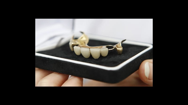 Rapinano una anziana in casa ad Asti, le rubano anche la dentiera