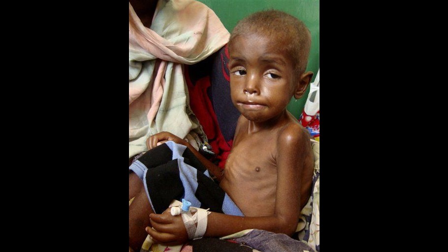 Somalia, partito dal Kenya aereo con aiuti per bambini malnutriti