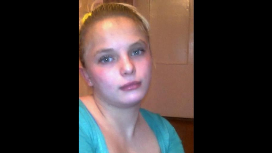 Ucraina, è morta la 18enne stuprata e bruciata viva 3 settimane fa