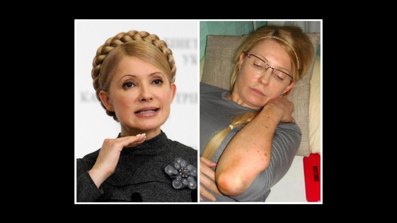 Ucraina, Tymoshenko trasferita dal carcere in ospedale di Kharkiv