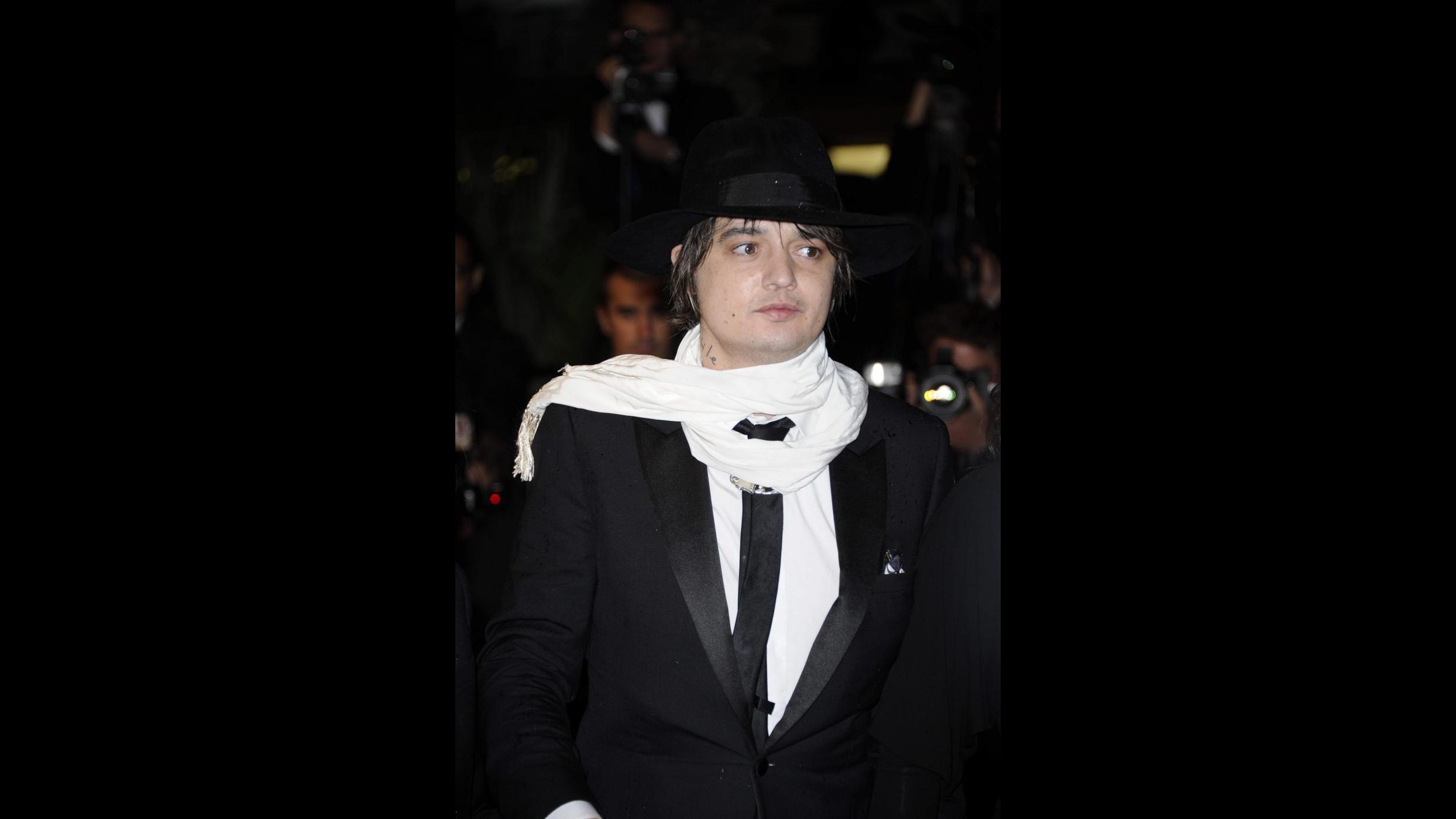 Pete Doherty: La Moss bruciò mio orsacchiotto e mi colpì con chitarra