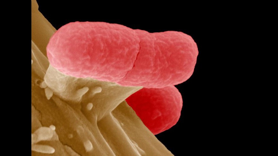 Usa, ucciso da Escherichia coli: ritirata ricotta pugliese da mercato
