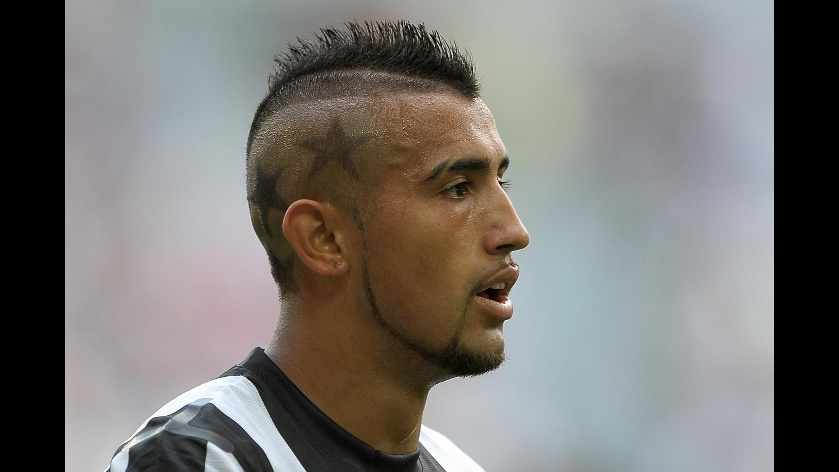 Juventus, elongazione all’adduttore e 7/8 giorni stop per Vidal. Llorente torna in Nazionale