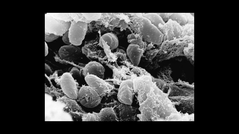 Madagascar, epidemia di peste bubbonica: 32 morti, 84 casi sospetti