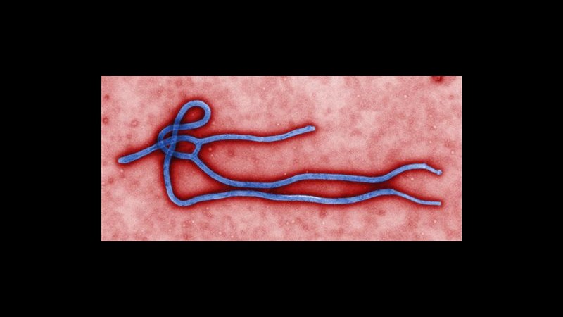 SCHEDA Ebola, cosa sapere sul virus: la parola agli esperti