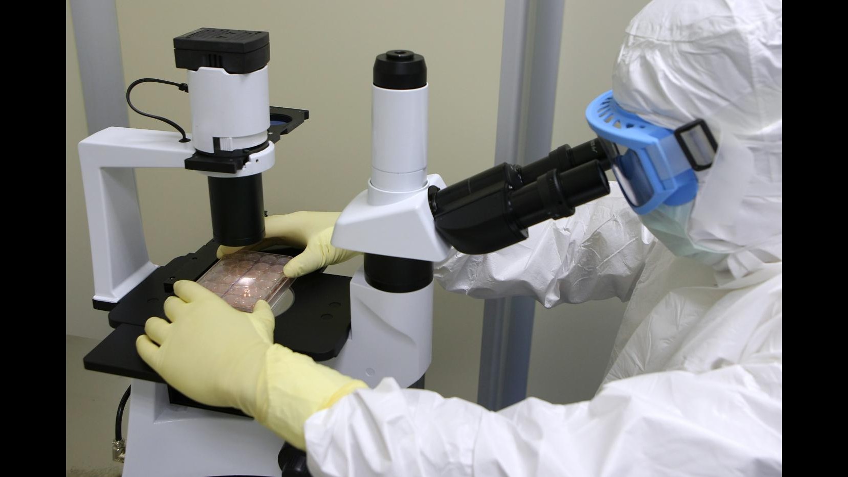 Terapia genica Telethon, 6 bambini curati da malattie genetiche con virus Hiv