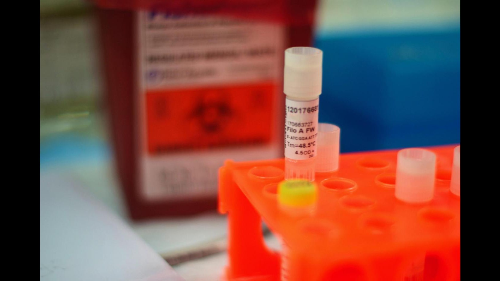 Ebola, primo caso sospetto nelle Marche