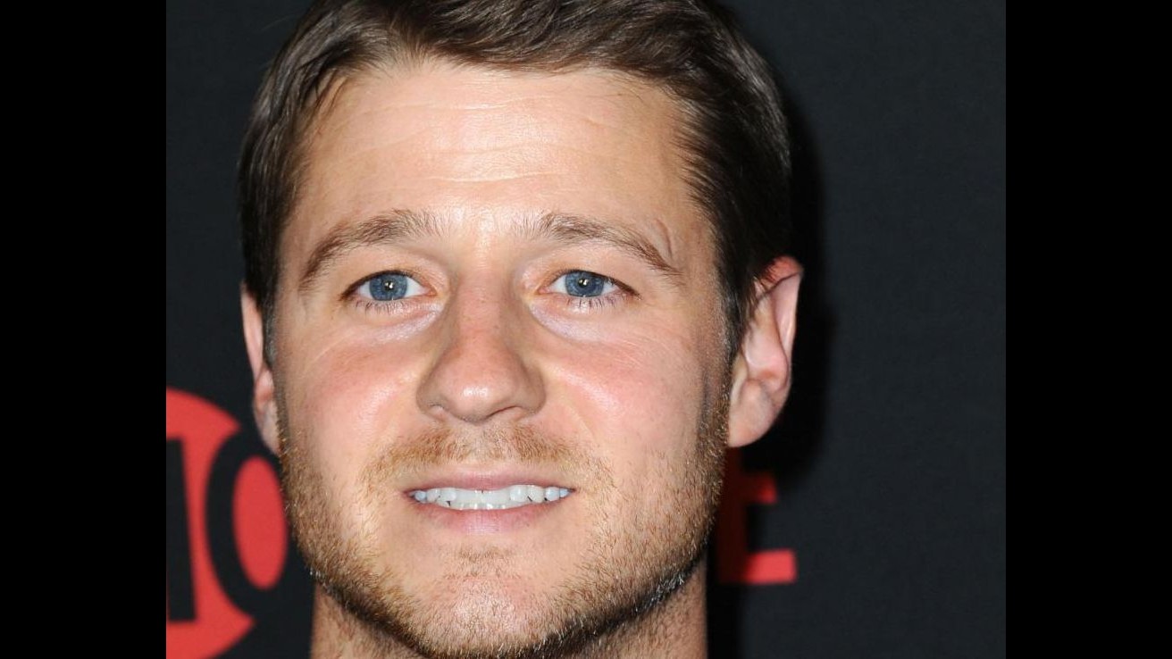 Ben McKenzie ferito a testa sul set ‘Gotham’: Volevo fare come mio stuntman