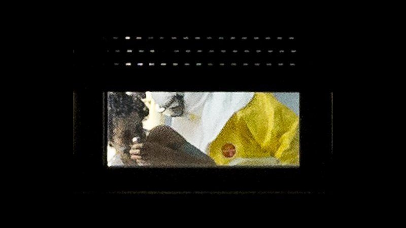 Ebola, condizioni infermiera spagnola migliorano leggermente
