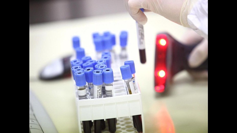 Da studio di Cnr e Istituto Pasteur nuova speranza contro Hiv e Aids