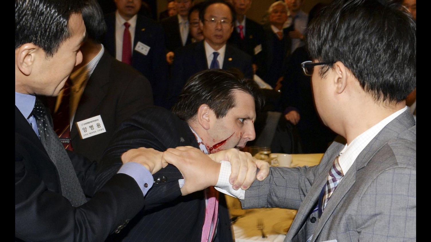 Sud Corea, ambasciatore Usa aggredito: ferito al volto da coltellata