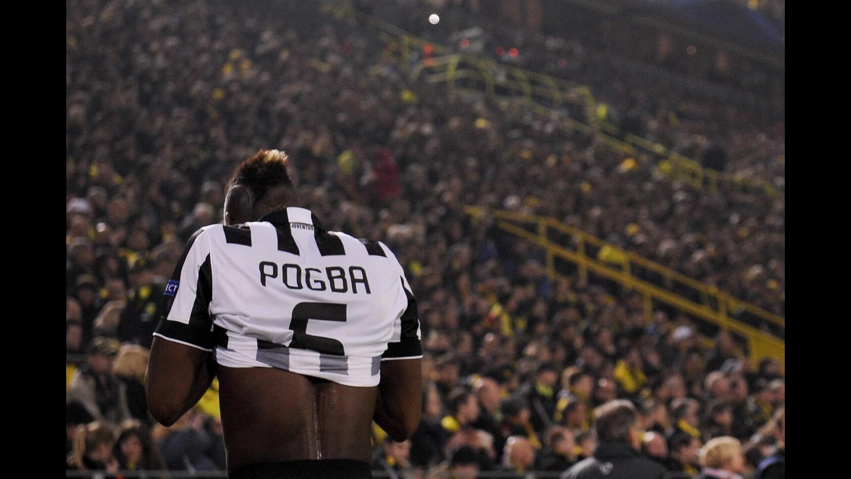 Juventus, tegola per Allegri: stop 50 giorni, Pogba salta quarti Champions League