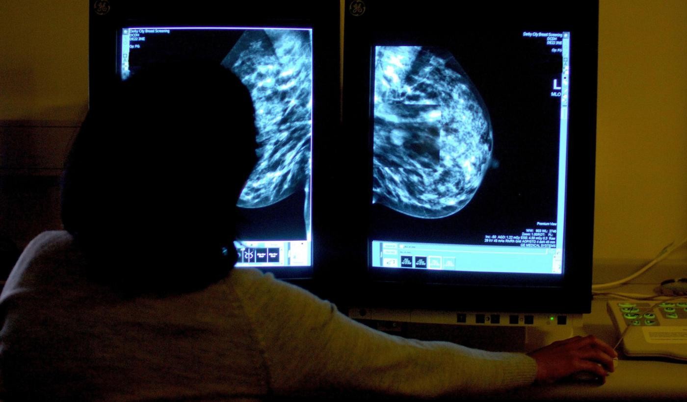 Salute, in dieci anni aumentati del 10% tumori al seno