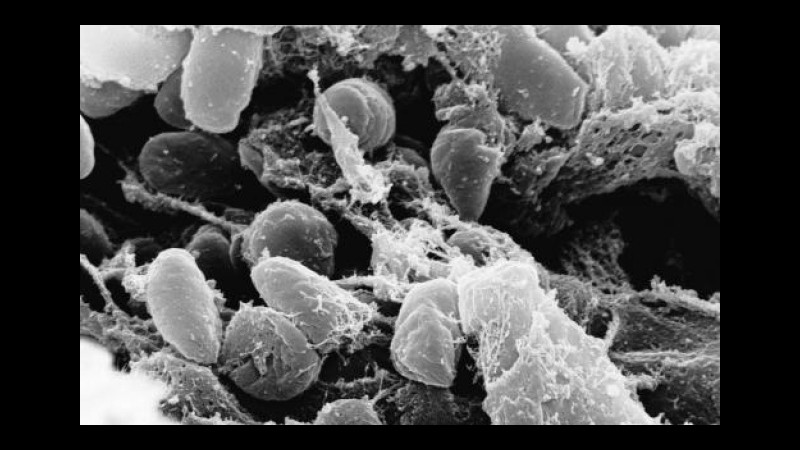 Usa, altri tre morti per peste bubbonica: nel 2015 già 11 decessi