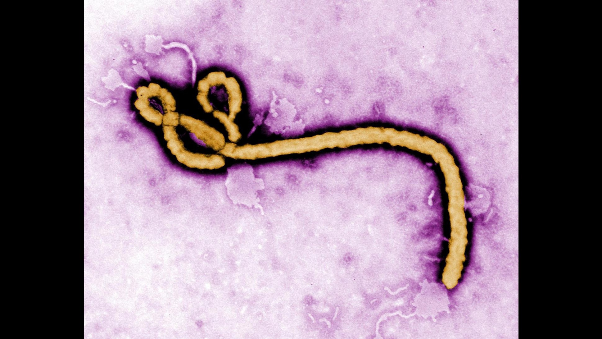 Ebola, Oms: Prima settimana senza nuovi casi in Africa occidentale