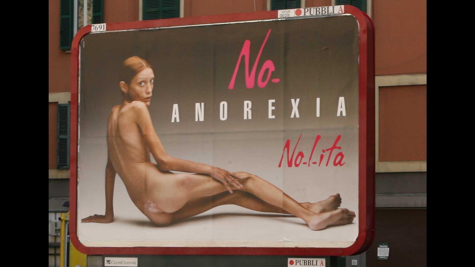Salute, domani al Bambino Gesù convegno e documentario sull’anoressia