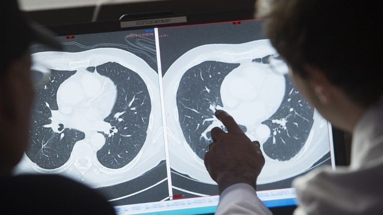 Via libera alla terapia cellulare CAR-T contro linfomi e leucemia Lla