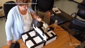 Impiantata a una italiana la prima mano bionica con il tatto
