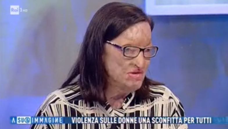 Il Papa scrive a Filomena, sfigurata con l’acido dal marito: “Chiedo perdono”