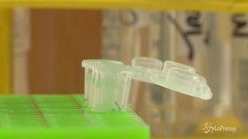 Hiv, parte la sperimentazione del vaccino pediatrico
